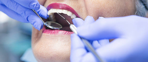 Best Dentist for Tooth Abscess  in Renton, WA